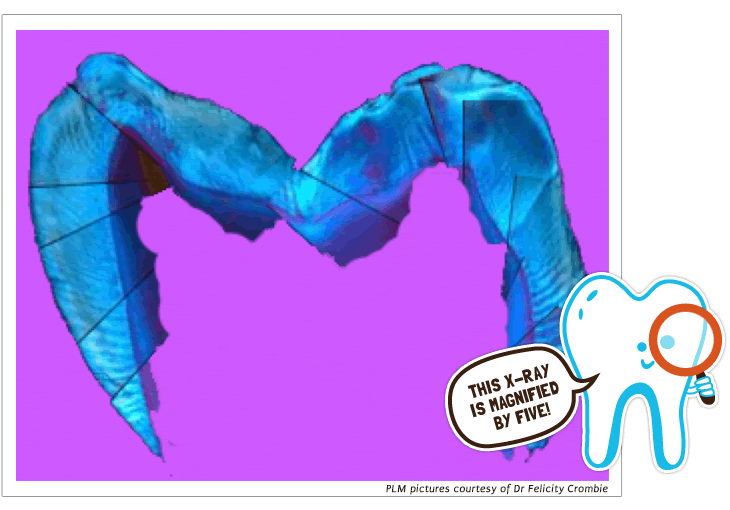 kids-missingbricks-mainImag kids-missingbricks-mainImag