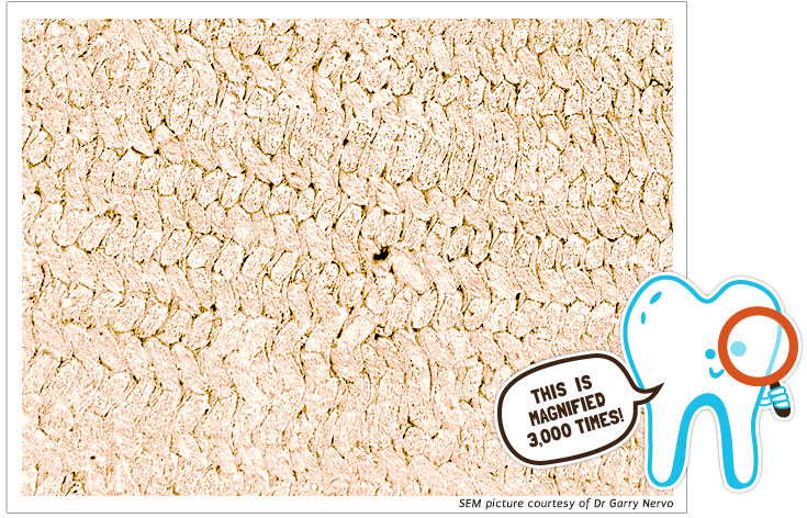 Magnification of Tooth Brick Magnification of Tooth Brick